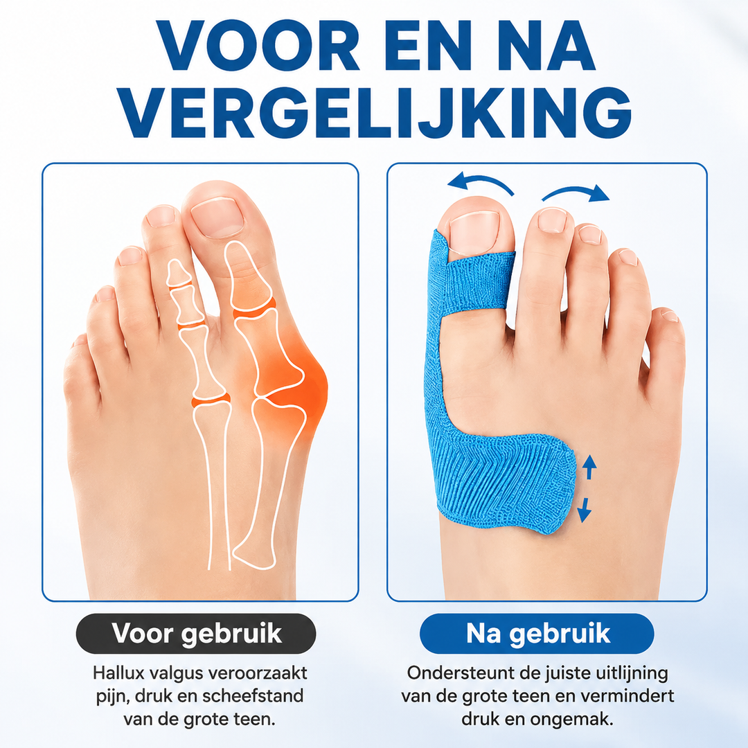 HalluxSupport | Hallux Valgus Tape voor Dagelijkse Ondersteuning