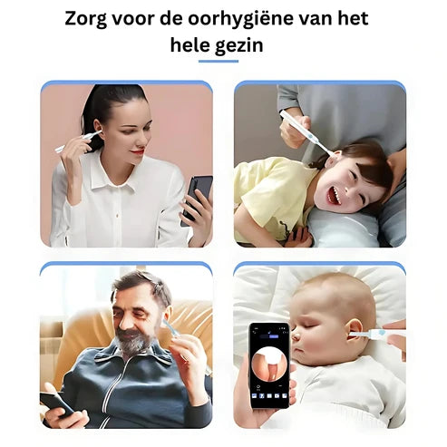 ClearEar | Visuele Oorreiniger met HD Camera