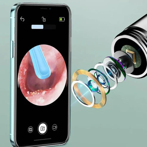 ClearEar | Visuele Oorreiniger met HD Camera