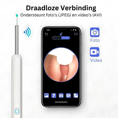 ClearEar | Visuele Oorreiniger met HD Camera